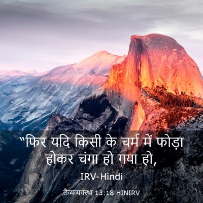 Picture 03 - लैव्यव्यवस्था 13:18 HINIRV - “फिर यदि किसी के - Bible Verse Picture