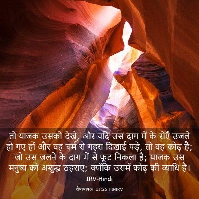 Picture 03 - लैव्यव्यवस्था 13:25 HINIRV - तो याजक उसको देखे, - Bible Verse Picture
