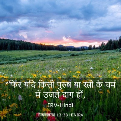 Picture 03 - लैव्यव्यवस्था 13:38 HINIRV - “फिर यदि किसी - Bible Verse Picture