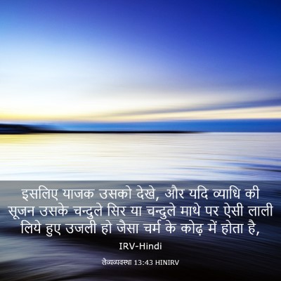 Picture 03 - लैव्यव्यवस्था 13:43 HINIRV - इसलिए याजक उसको - Bible Verse Picture