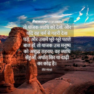Picture 04 - लैव्यव्यवस्था 13:30 HINIRV - तो याजक व्याधि को - Bible Verse Picture