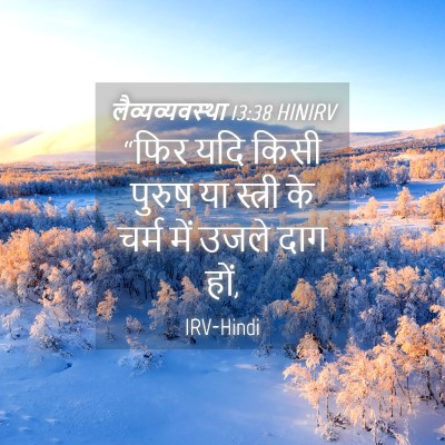 Picture 04 - लैव्यव्यवस्था 13:38 HINIRV - “फिर यदि किसी - Bible Verse Picture