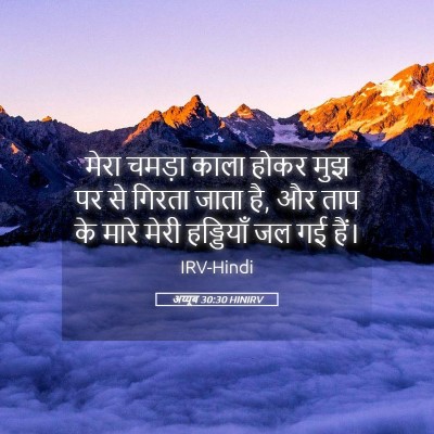 Picture 05 - अय्यूब 30:30 HINIRV - मेरा चमड़ा काला - Bible Verse Picture