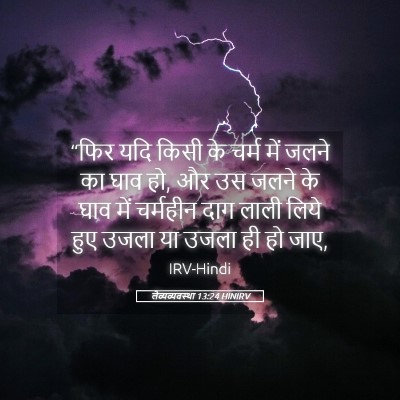 Picture 05 - लैव्यव्यवस्था 13:24 HINIRV - “फिर यदि किसी के - Bible Verse Picture