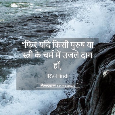 Picture 05 - लैव्यव्यवस्था 13:38 HINIRV - “फिर यदि किसी - Bible Verse Picture
