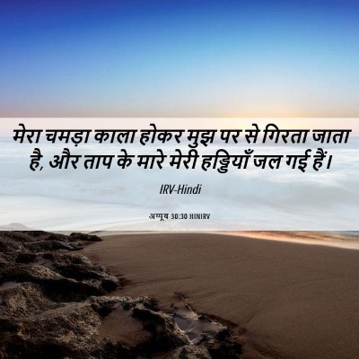 Picture 06 - अय्यूब 30:30 HINIRV - मेरा चमड़ा काला - Bible Verse Picture
