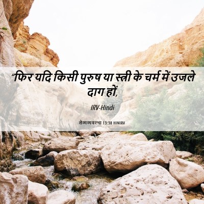 Picture 06 - लैव्यव्यवस्था 13:38 HINIRV - “फिर यदि किसी - Bible Verse Picture